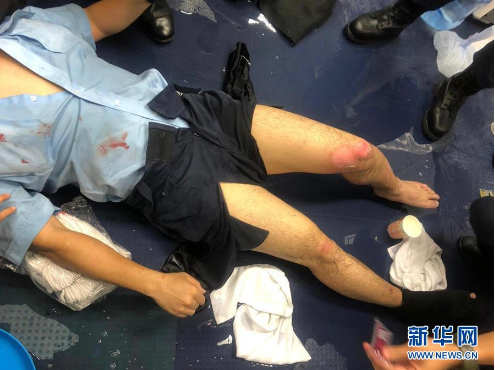 香港有暴徒在多处投掷汽油弹 一名警察被严重烧伤