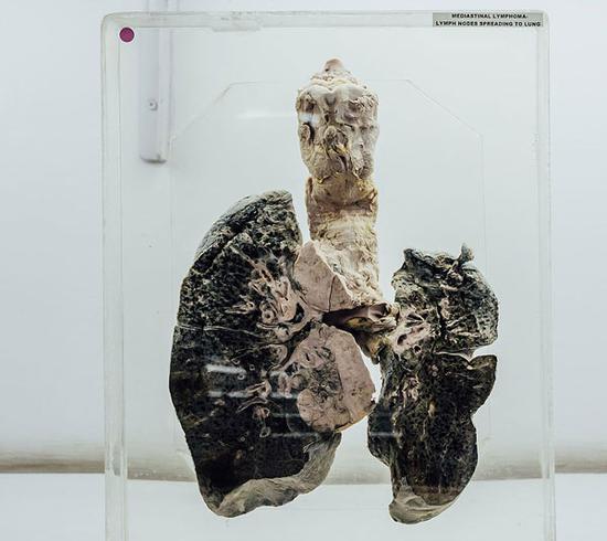 印博物馆展出数百具人脑标本 游客可用手触摸(图)