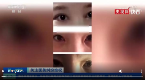 整容变毁容!女子花近8万整容整出九级伤残_杭州网