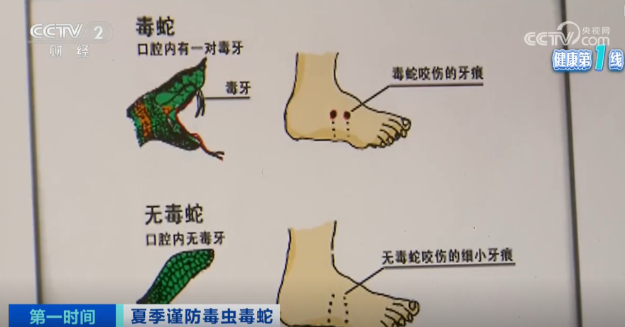 上海医院接诊蛇咬伤事件增多，如何辨别是否为毒蛇所咬