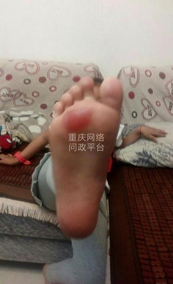 重庆小学老师罚学生赤脚跑操场:有孩子脚底磨出泡